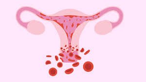Abnormal Uterine Bleeding Treatment